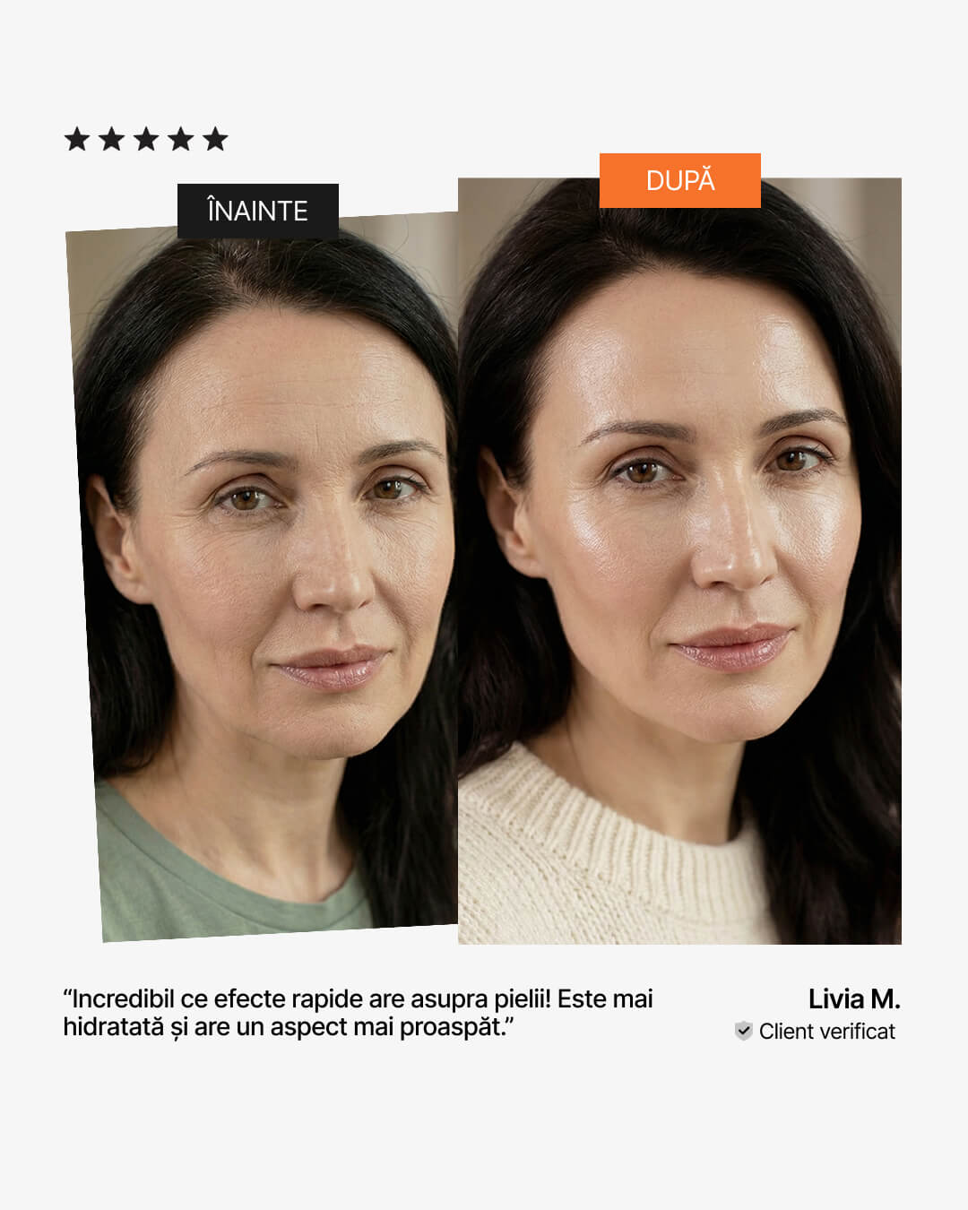 Rezultate colagen lichid – înainte și după: piele mai hidratată și cu aspect mai proaspăt, recenzie verificată 21Collagen