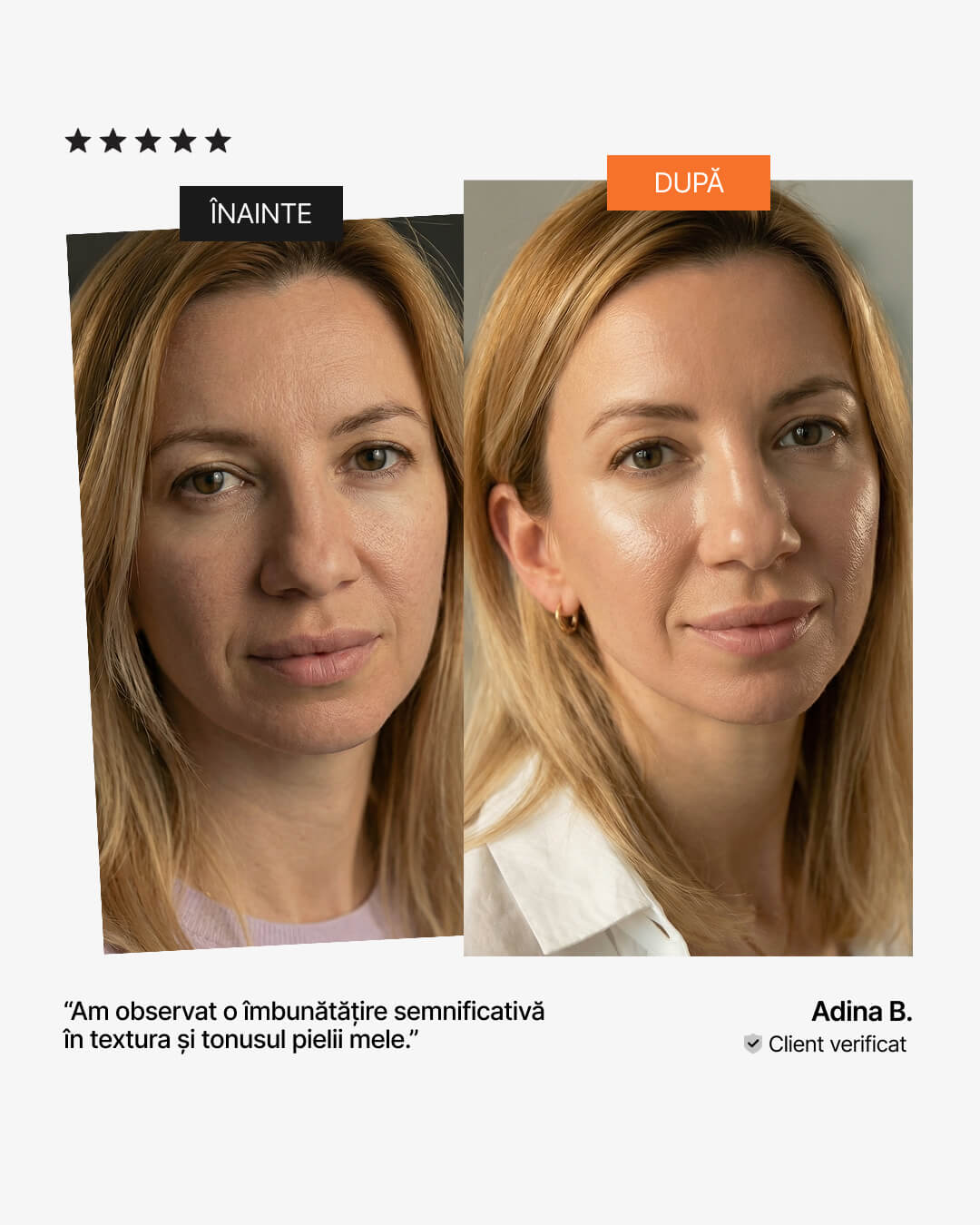 Colagen pentru ten – înainte și după: textură și tonus îmbunătățit vizibil, pareri 21Collagen