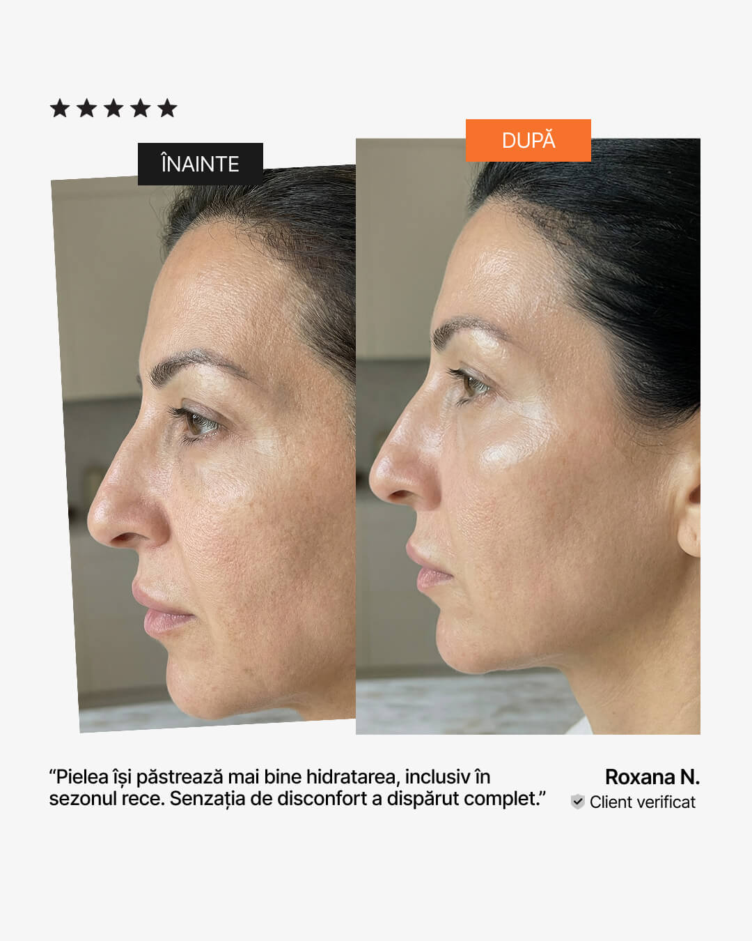 Colagen lichid pentru piele uscată – înainte și după: hidratare mai bună în sezonul rece, recenzie 21Collagen