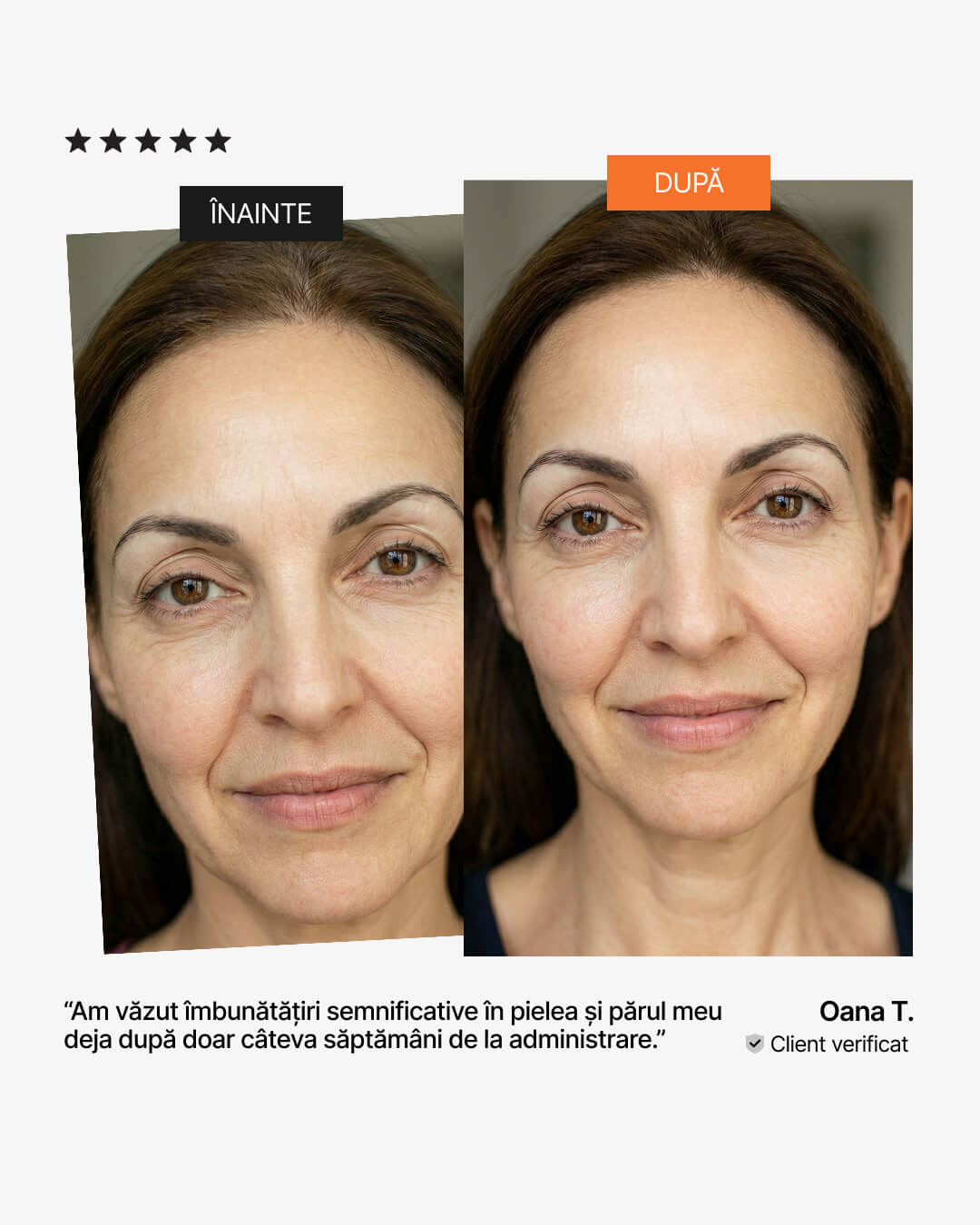 Colagen pentru piele și păr – înainte și după: rezultate vizibile după câteva săptămâni, pareri 21Collagen