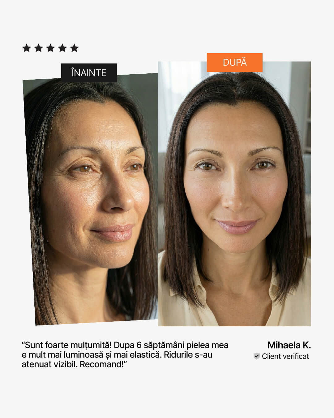 Efect colagen lichid după 6 săptămâni – înainte și după: riduri atenuate, piele luminoasă și elastică, 21Collagen