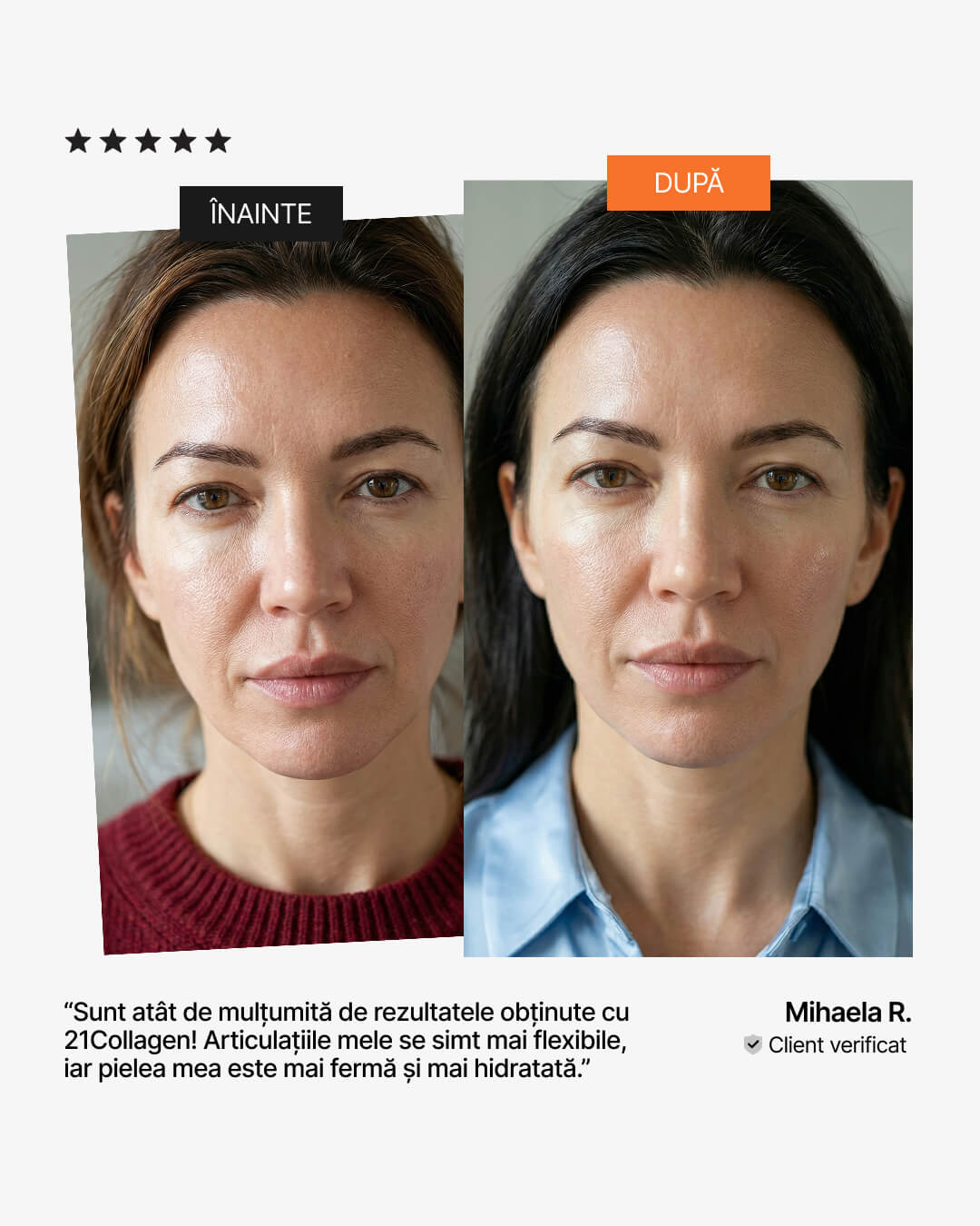 Colagen pentru articulatii și piele – înainte și după: ten mai ferm și hidratat, pareri 21Collagen